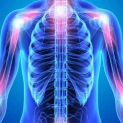 Inflammation